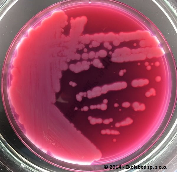 You are currently viewing Bacillus cereus in food