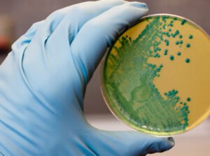 Read more about the article Listeria monocytogenes as a threat in the food industry